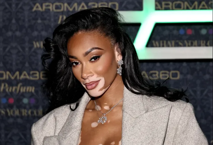 winnie harlow net worth