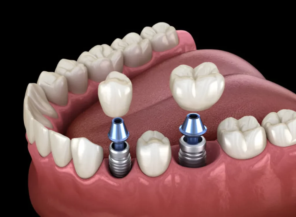 Unlocking a Radiant Complexion with B3 Serum