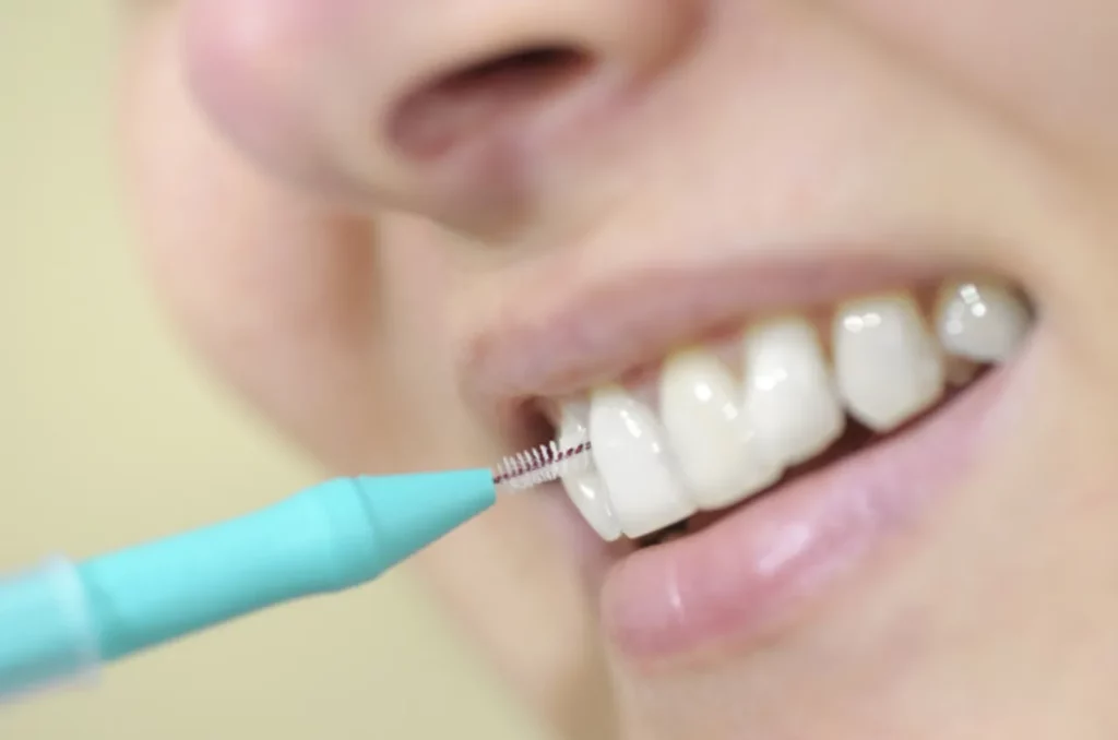 How to Use Interdental Brushes the Right Way