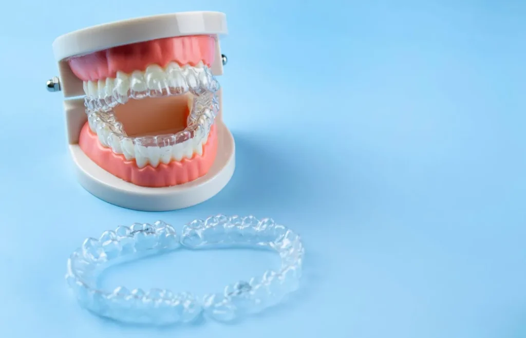 Why Custom Treatment Plans Matter With Tidal Aligners