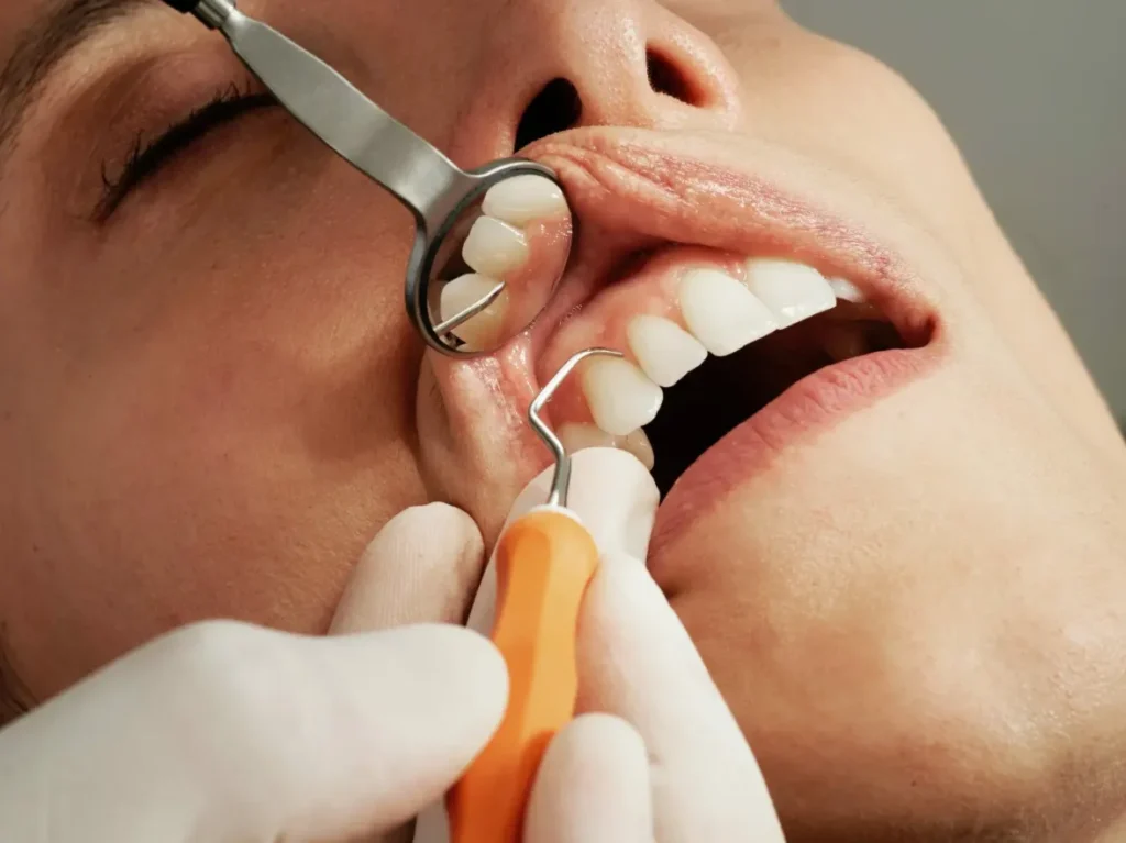 6 Preventive Tools Dentists Use To Strengthen Teeth And Gums 6 Preventive Tools Dentists Use To Strengthen Teeth And Gums