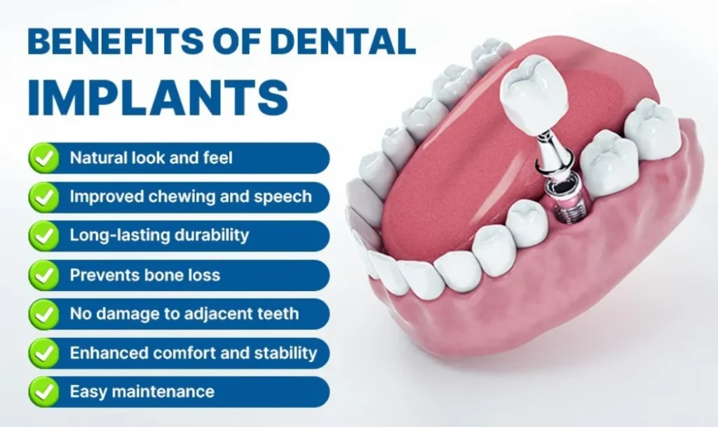 Why Implants Protect Adjacent Natural Teeth Why Implants Protect Adjacent Natural Teeth